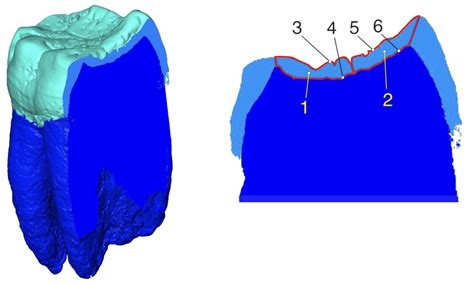 measurement of tooth enamel thickness|soft enamel vs hard teeth.